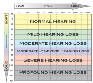degrees of hearing loss