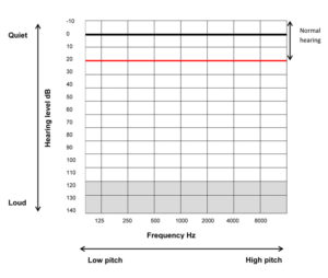simple audiogram and parts